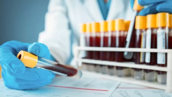 На Житомирщині можна продіагностувати новонароджених на наявність рідкісних захворювань