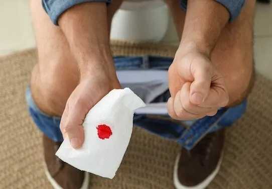 Почему появляется кровь в кале: причины и диагностика