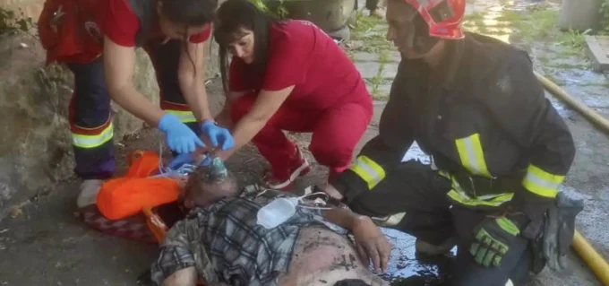 На Житомирщині з вогню врятували 65-річного чоловіка