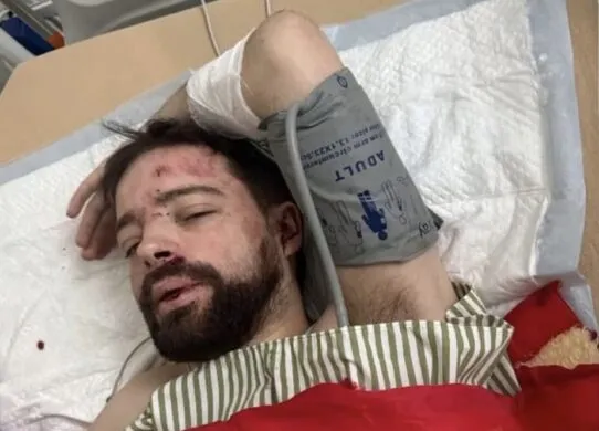 Скандал навколо працівника львівського університету: його побитого знайшли на дорозі під Житомиром