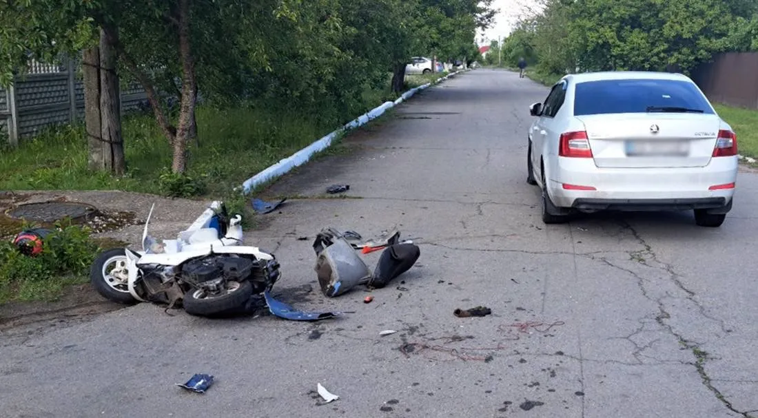 В Брусилові двоє підлітків потрапили в ДТП на мопеді - 11-річний хлопчик у лікарні
