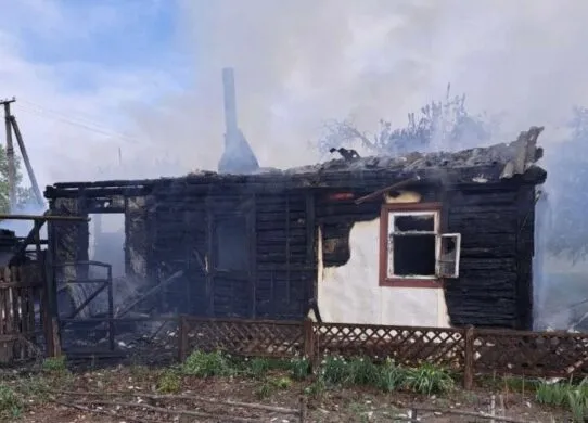 Пожежа у Житомирському районі: 33-річний чоловік отримав опіки