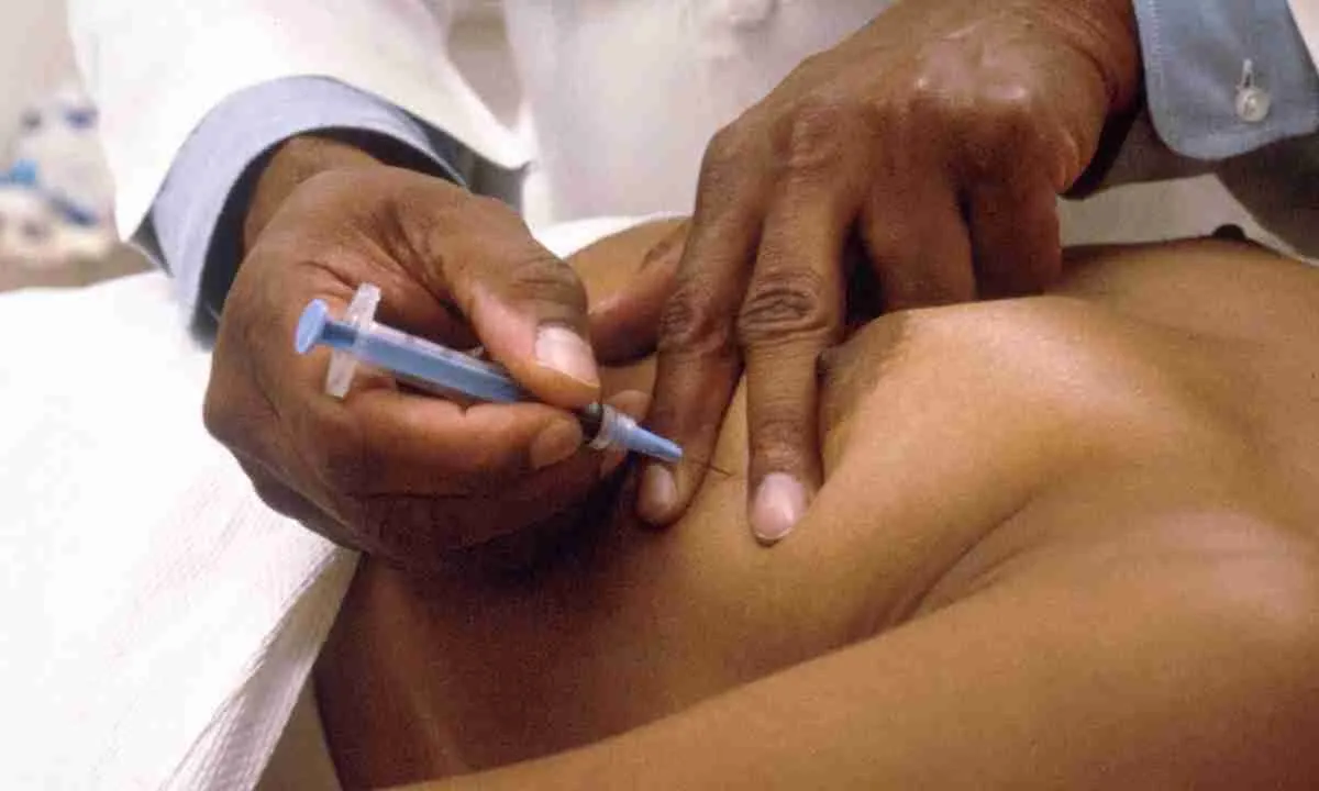 Чому ексцизійна біопсія є настільки важливою?