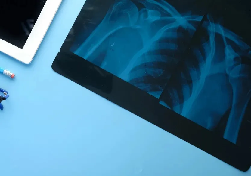 Пульмонология в Германии – где получить качественное лечение