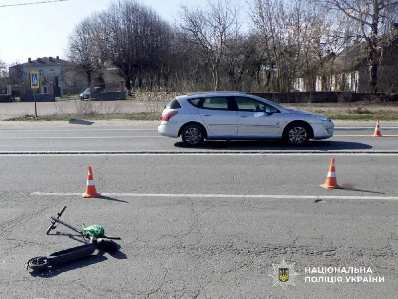 На Житомирщині Peugeot збив 11-річного хлопця на електросамокаті
