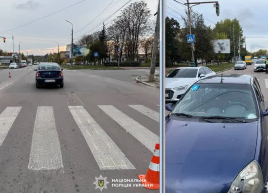 У Бердичеві на пішохідному переході збили жінку: постраждала в реанімації