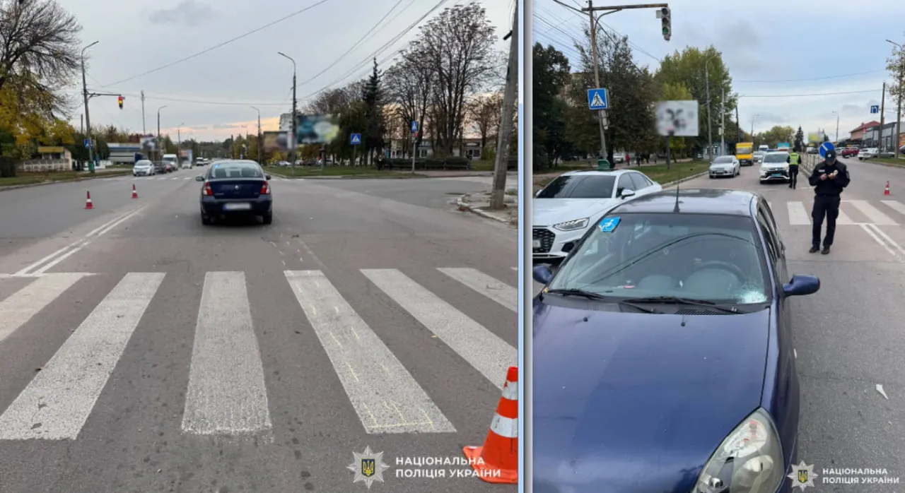У Бердичеві на пішохідному переході збили жінку: постраждала в реанімації